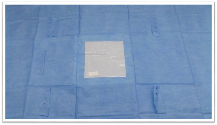 Laparotomy Drape 