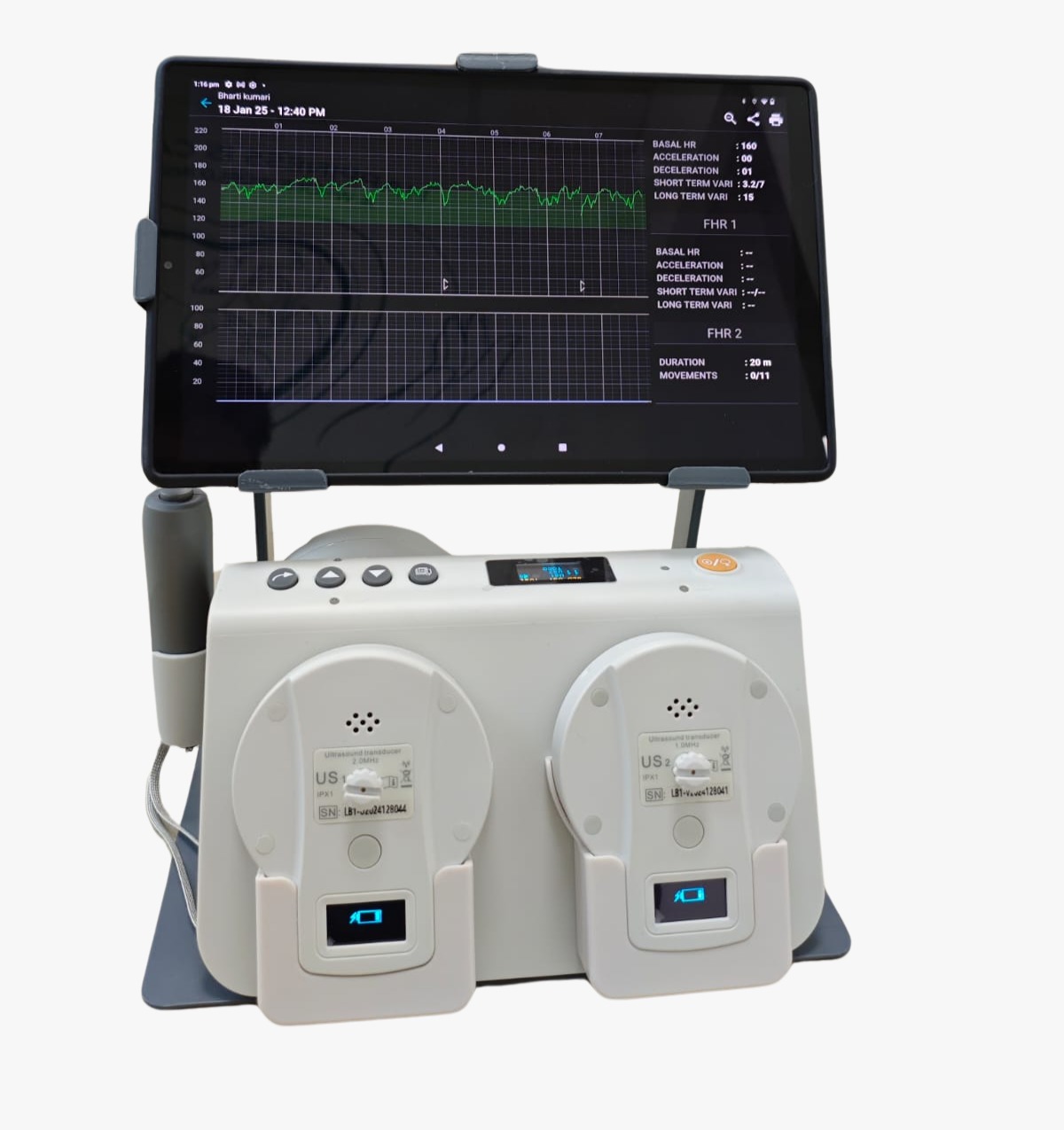 Fetosense NST/CTG Plus